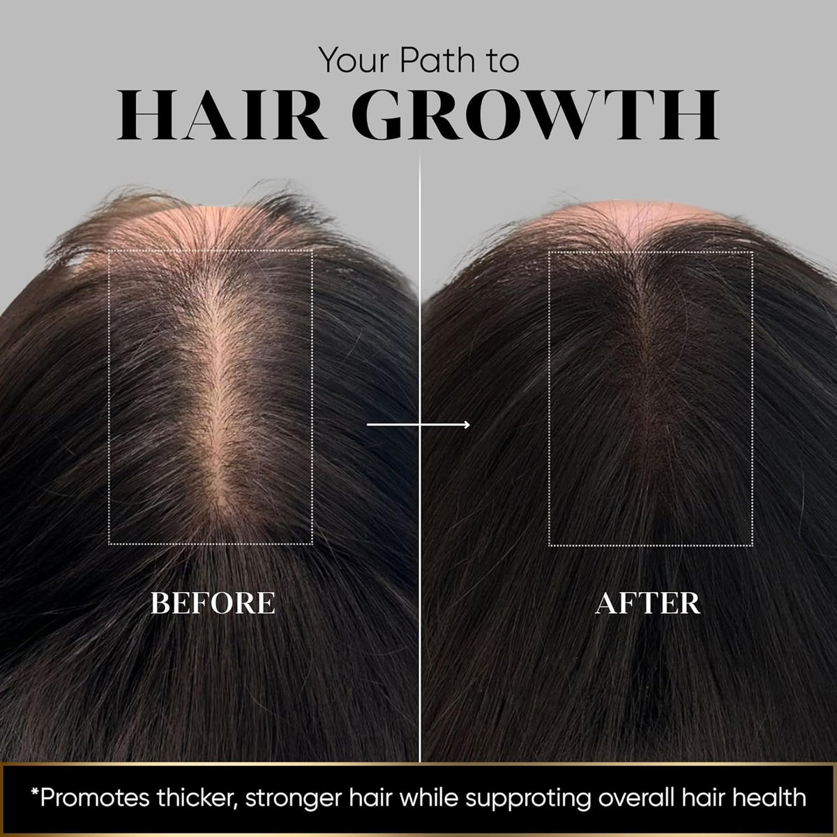 Vita Hair Micronized 108 capsules